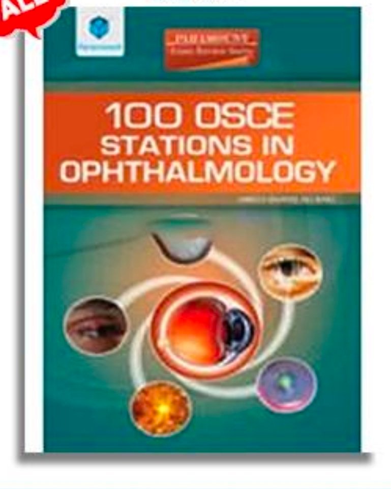 100 OSCE Stations in Ophthalmology